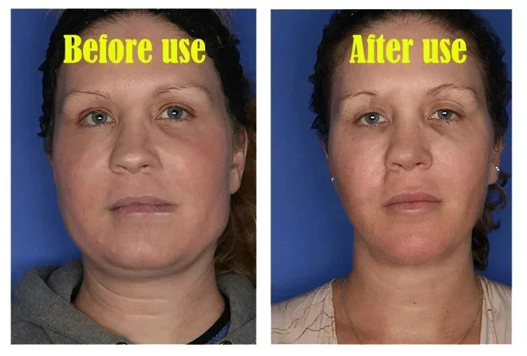 V-Shape Face Slimming Cream Remove Double Chins Firming Lifting Up V Cheek Fat Burning Anti-aging Shaping Massage Care Products