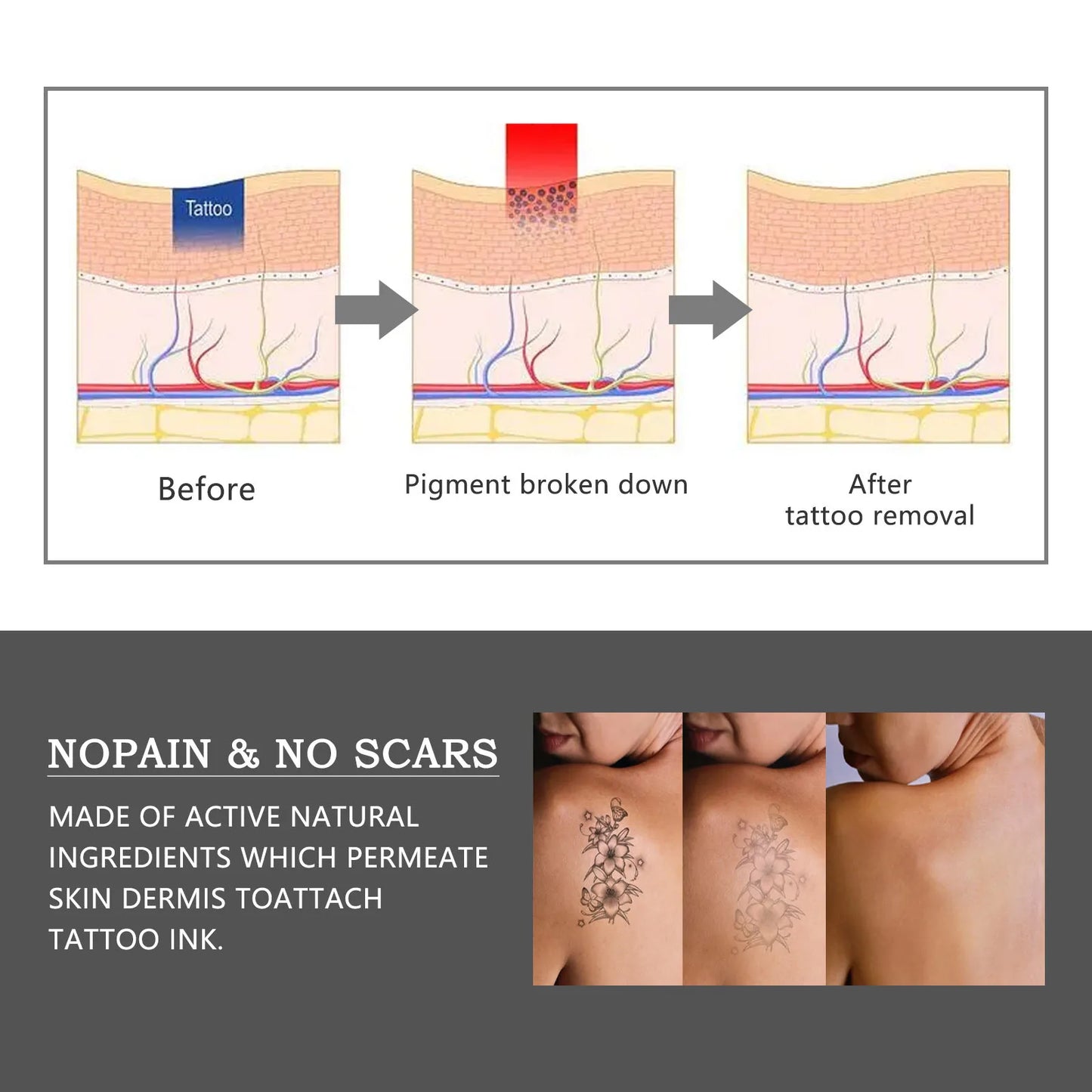 Tattoo Removal Cream Tattoo Color Fade Bleaching Makeup Eyebrow Lips Eyeliner Body Quick Elimination Permanent Tattoo Remover