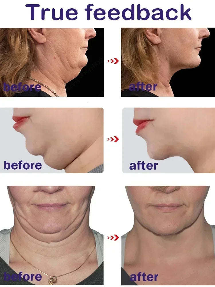 V-Shape Face Slimming Cream Remove Double Chins Firming Lifting Up V Cheek Fat Burning Anti-aging Shaping Massage Care Products
