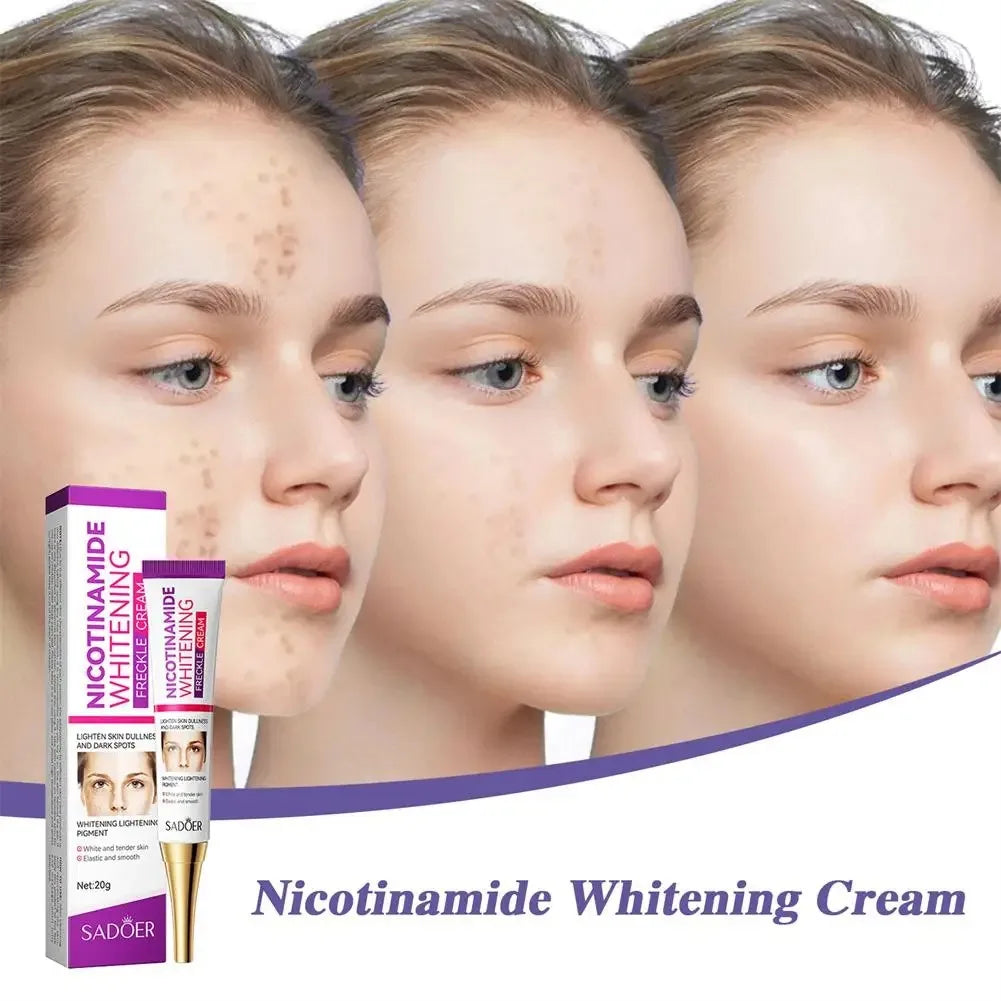Face Melasma Remover Cream Whitening Removal Freckles Cream Nicotinamide Moisturizing Brightening Emulsion Fade Dark Spots Care