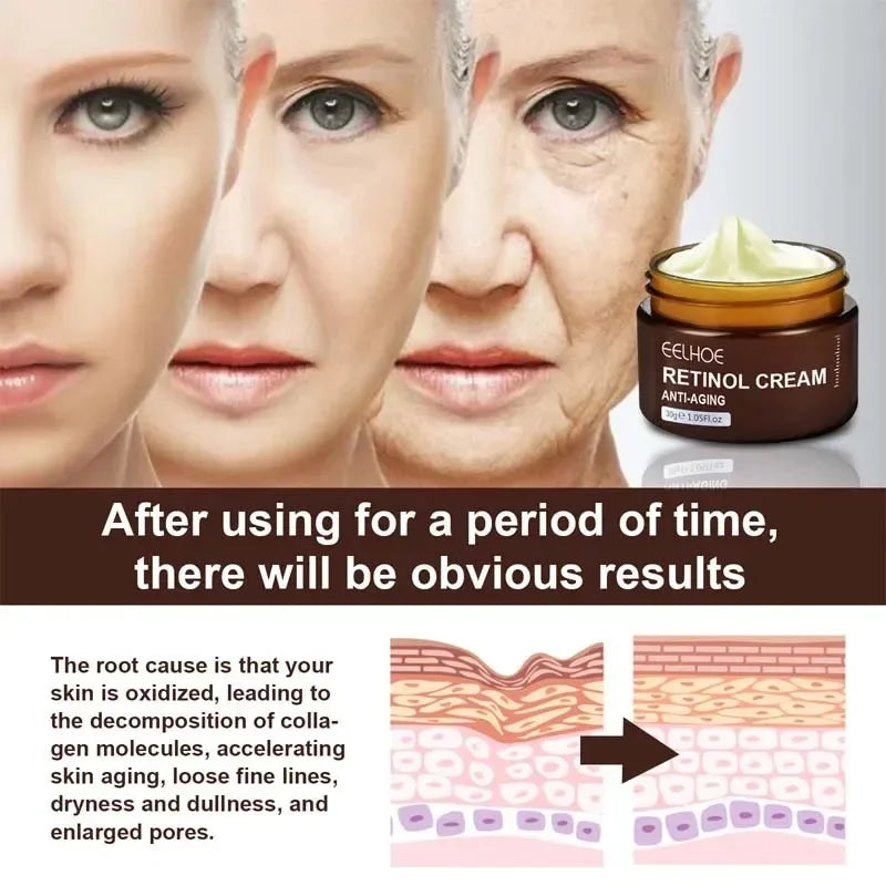 Retinol Anti Wrinkle Face Cream Set Anti-Aging Firming Lifting Fade Fine Line Serum Smooth Skin Whitening Moisturizing Skin Care