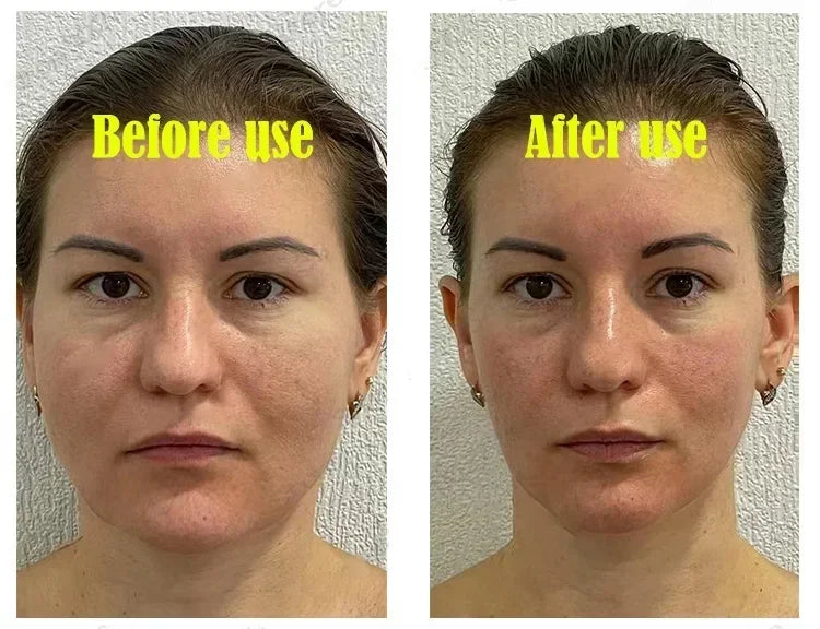 V-Shape Face Slimming Cream Remove Double Chins Firming Lifting Up V Cheek Fat Burning Anti-aging Shaping Massage Care Products