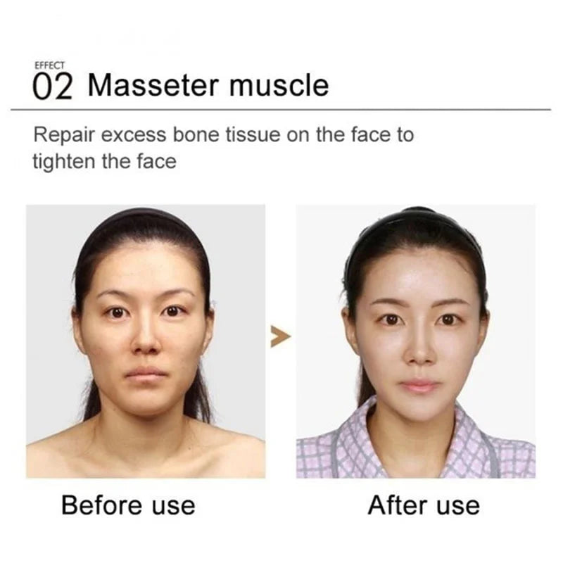 V-Shape Face Slimming Cream Remove Double Chins Firming Lifting Up V Cheek Fat Burning Anti-aging Shaping Massage Care Products
