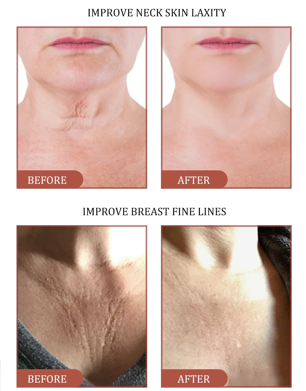 MOCILI Neck Cream Firming Anti Wrinkle Tightening Remove Dark Spot Whitening Massage Anti Aging Moisturizing Beauty Shape 50g