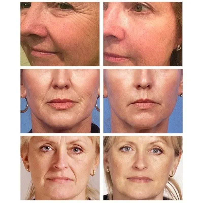 Retinol Anti Wrinkle Face Cream Set Anti-Aging Firming Lifting Fade Fine Line Serum Smooth Skin Whitening Moisturizing Skin Care