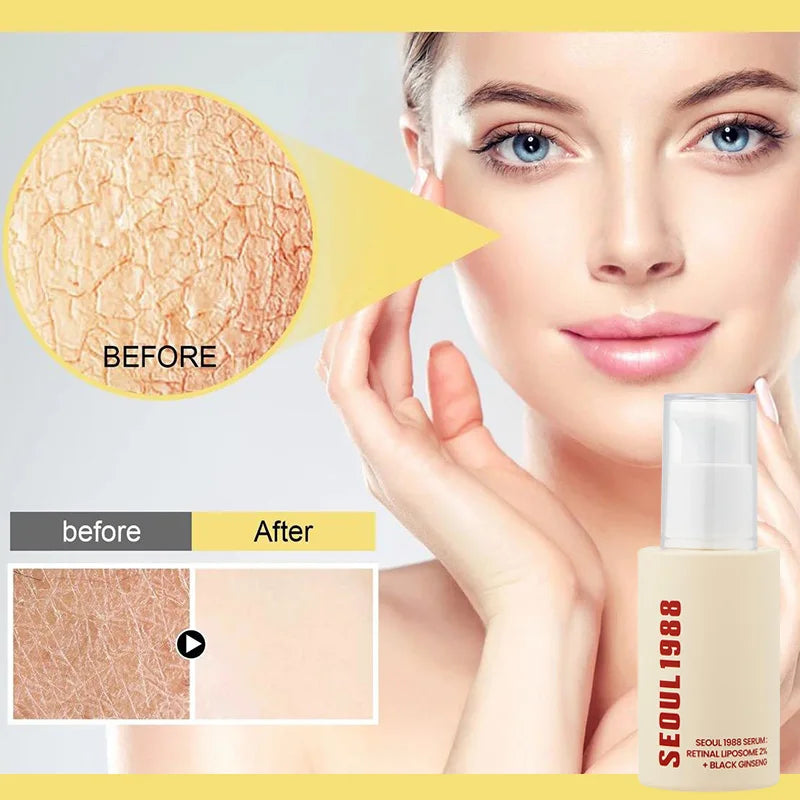 Retinol Essence Brand Ginseng Niacinamide Firming Repair Deep Moisturizing Brightening Remove Closed Pore Essence Facial Care