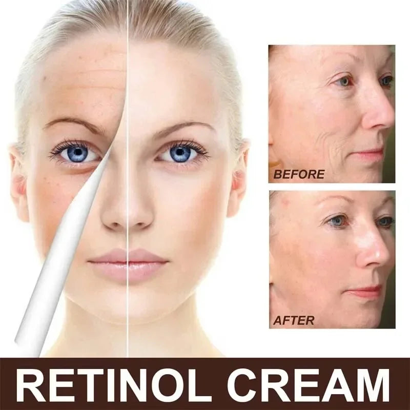 Retinol Anti Wrinkle Face Cream Set Anti-Aging Firming Lifting Fade Fine Line Serum Smooth Skin Whitening Moisturizing Skin Care