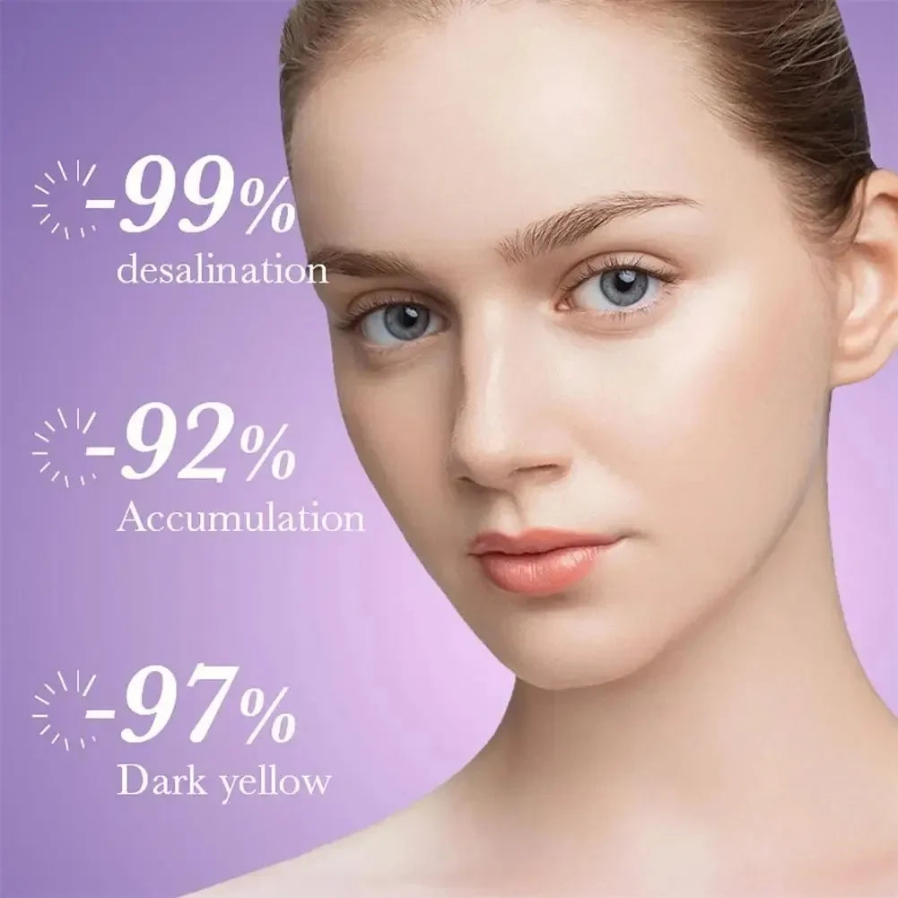 Face Melasma Remover Cream Whitening Removal Freckles Cream Nicotinamide Moisturizing Brightening Emulsion Fade Dark Spots Care