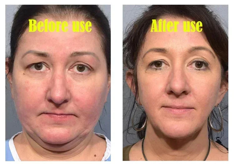 V-Shape Face Slimming Cream Remove Double Chins Firming Lifting Up V Cheek Fat Burning Anti-aging Shaping Massage Care Products