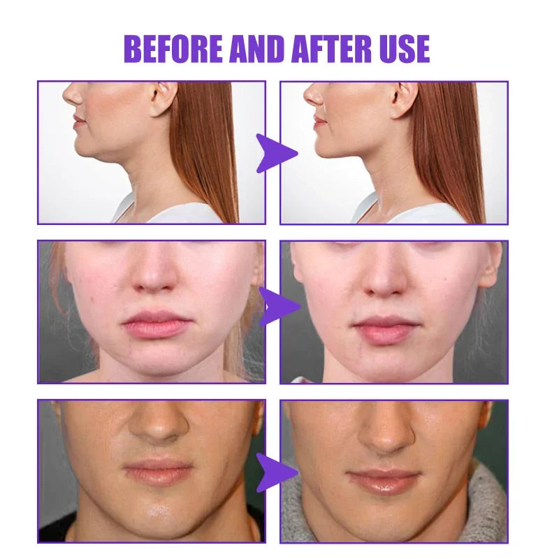 V-Shape Face Slimming Cream Remove Double Chins Firming Lifting Up V Cheek Fat Burning Anti-aging Shaping Massage Care Products