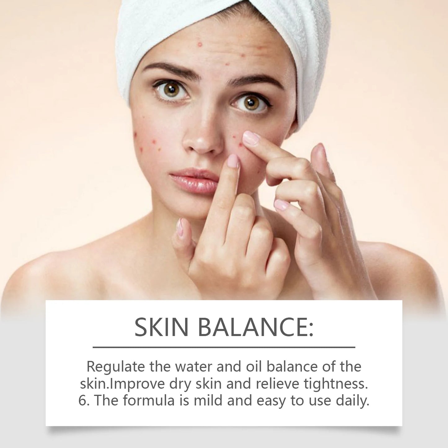Acne Removal Cream Repair Redness Lighten Pimple Spots Shrink Pore Oil Control Whitening Smoothing Moisturizing Facial Skin Care