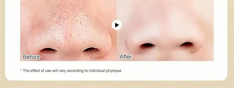 Gold Remove Blackhead Peel Mask Deep Cleansing Pore Dirt Cleansing Cosmetic Residue Exfoliating Cleansing Mask Oil Control Facia