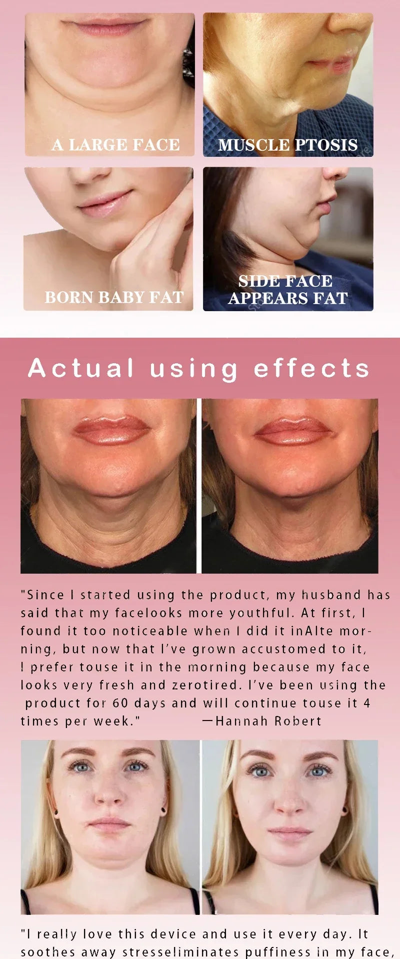 V-Shape Face Slimming Cream Remove Double Chins Firming Lifting Up V Cheek Fat Burning Anti-aging Shaping Massage Care Products