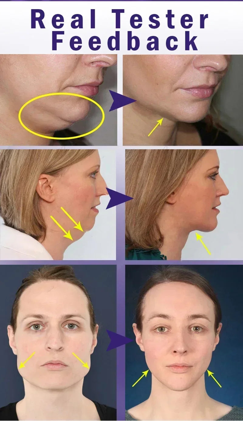 V-Shape Face Slimming Cream Remove Double Chins Firming Lifting Up V Cheek Fat Burning Anti-aging Shaping Massage Care Products